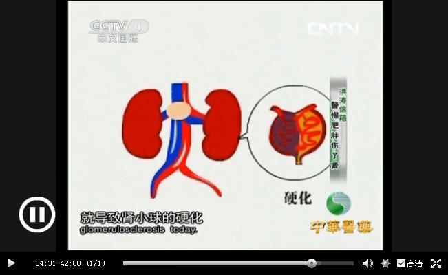 CCTV｛中华医药｝20130925《肥胖相关性肾病》_018.jpg