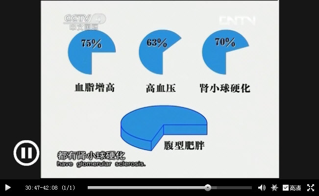 CCTV｛中华医药｝20130925《肥胖相关性肾病》_012.jpg