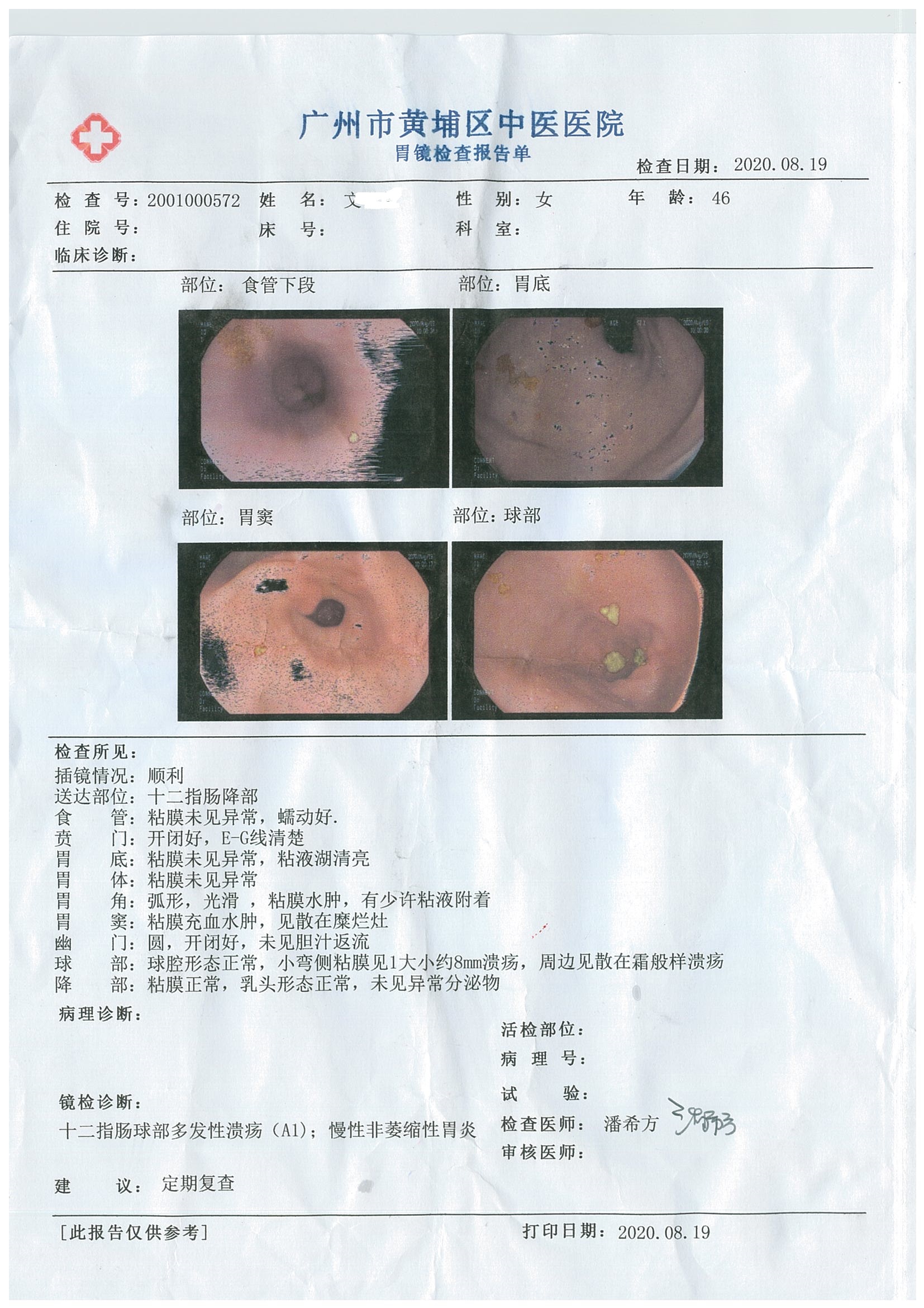 胃镜20200819.jpg