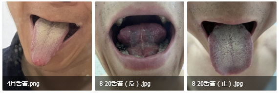 看这舌头的形状和面部肌肉的紧张程度，那不是一般的郁.jpg