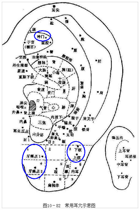 可以再配合按压三个耳穴：牙痛点、上下颌、神门。2.jpg