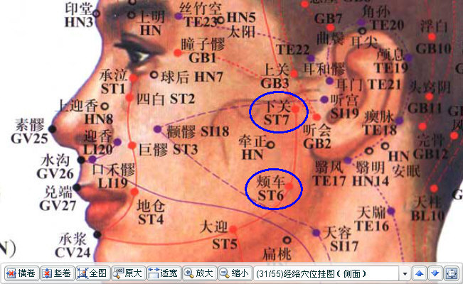 上牙痛再近取一个足阳明胃经上的下关更好（下牙痛取颊车）。.jpg