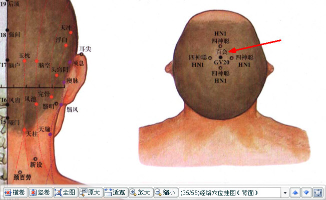 百会（督脉）.JPG