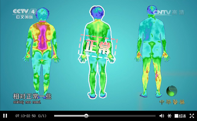 《人体热量分布：红外热成像图》张晋和孙其伟两位专家做客节目，讲述看不见摸不着的气血，向大家深度解读怎样通过气血来判断健康状况。2.jpg