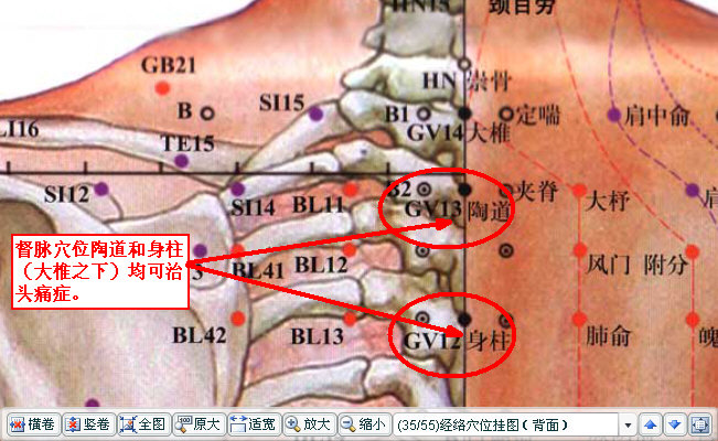 督脉穴位陶道和身柱（大椎之下）均可治疗头痛症.jpg