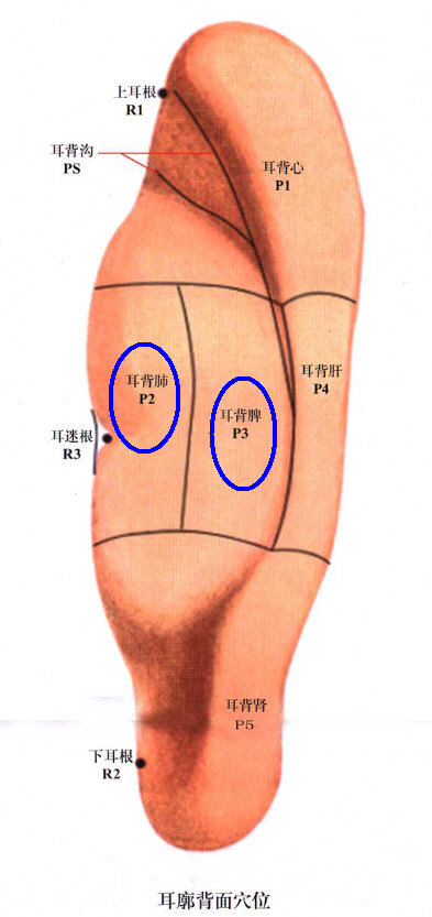 耳穴按压治疗肺癌化疗后胃肠反应：耳背肺、耳背脾.jpg