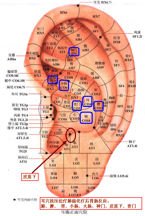 耳穴按压治疗肺癌化疗后胃肠反应：肺、脾、 胃、小肠、大肠、神门、皮质下、贲门.jpg