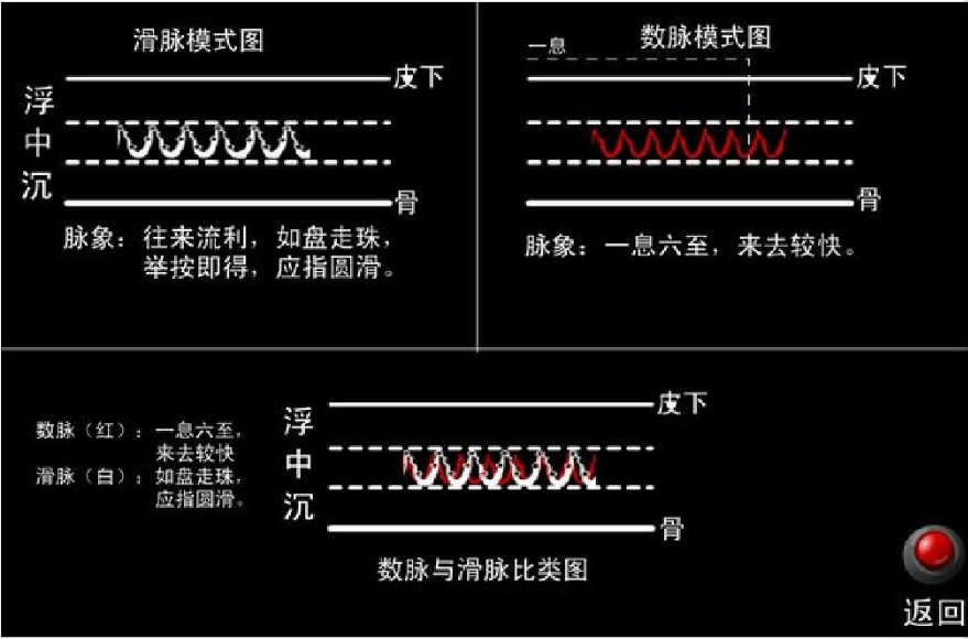 脉图1.png