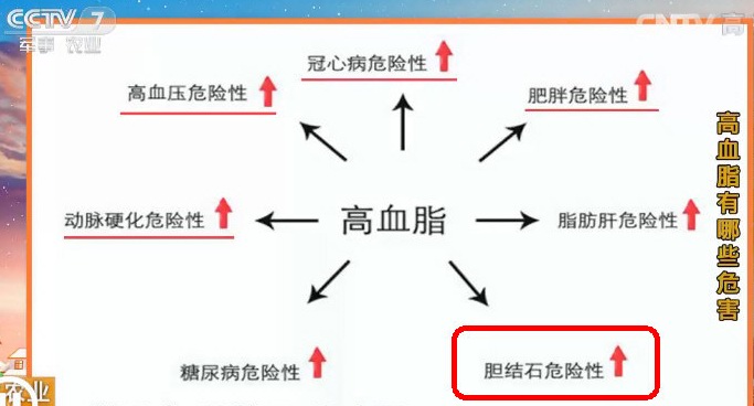 高血脂是导致结石的主要因素之一，那些终日膏梁厚味的人，容易得胆肾结石，只要生活方式没改变，排了还会再长。.jpg