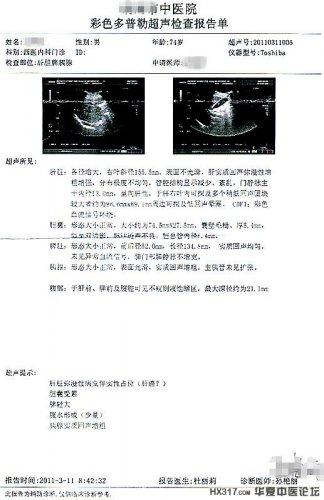 肝癌晚期扩散（二）.jpg