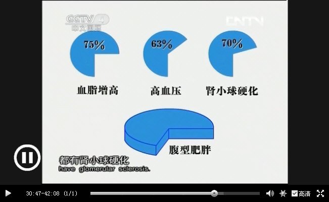 中华医药20130925拍出好身板：肥胖相关性肾病_335.jpg