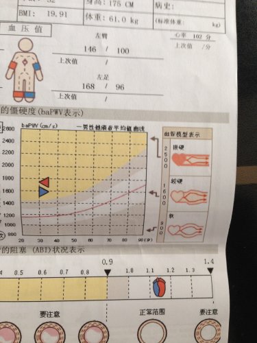 2014,05,06医大动脉硬化测试.JPG