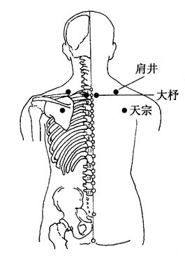 颈椎病穴位.jpg